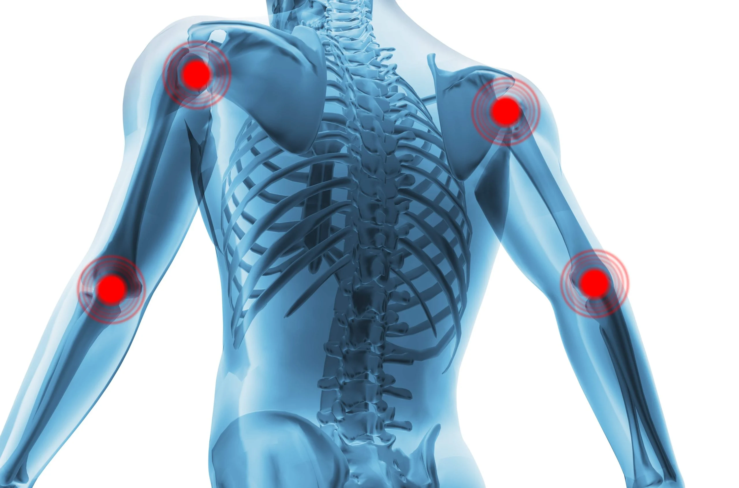 Musculoskeletal Medicine at DermaCare Family Health